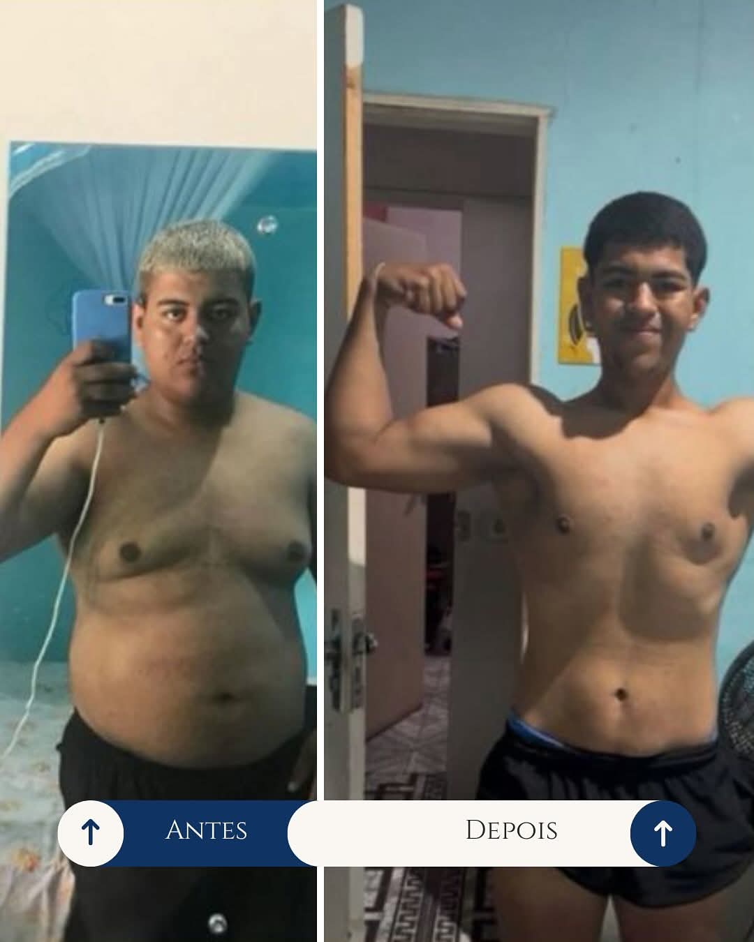 Antes e depois da jornada de emagrecimento